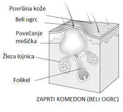 Beli ogrc Beli ogrc