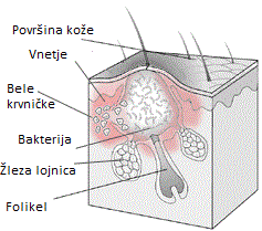 Papula Papula