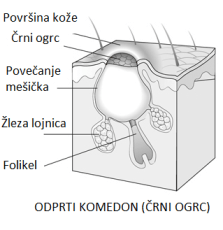 Črni ogrc Črni ogrc