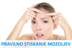 stiskanje mozoljev na pravilen način